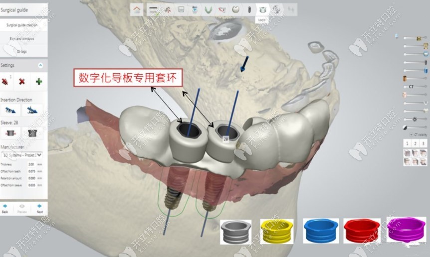 菲森科技2024华南国际口腔展圆满收官！一站式口腔数字化解决方案闪耀全场