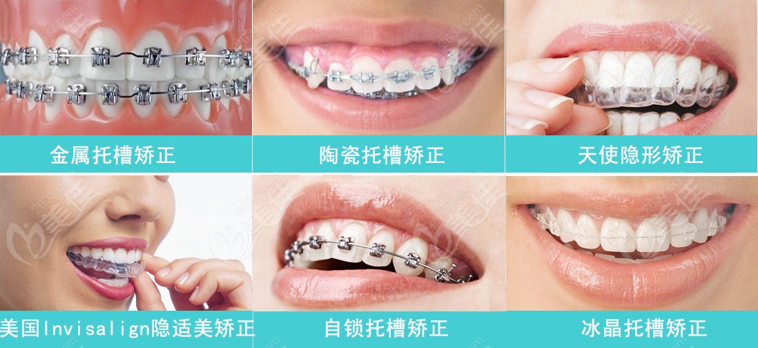 儿童牙齿矫正不是越早越好