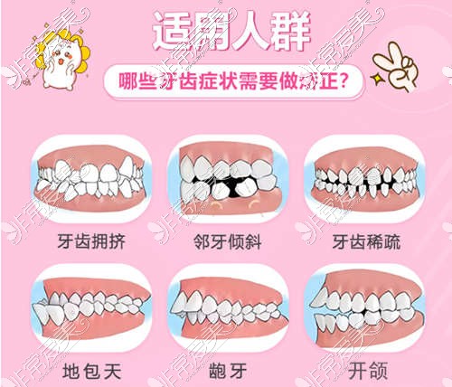 矫正牙齿时武汉一男子牙根被打断！院方回复：不是医疗事故
