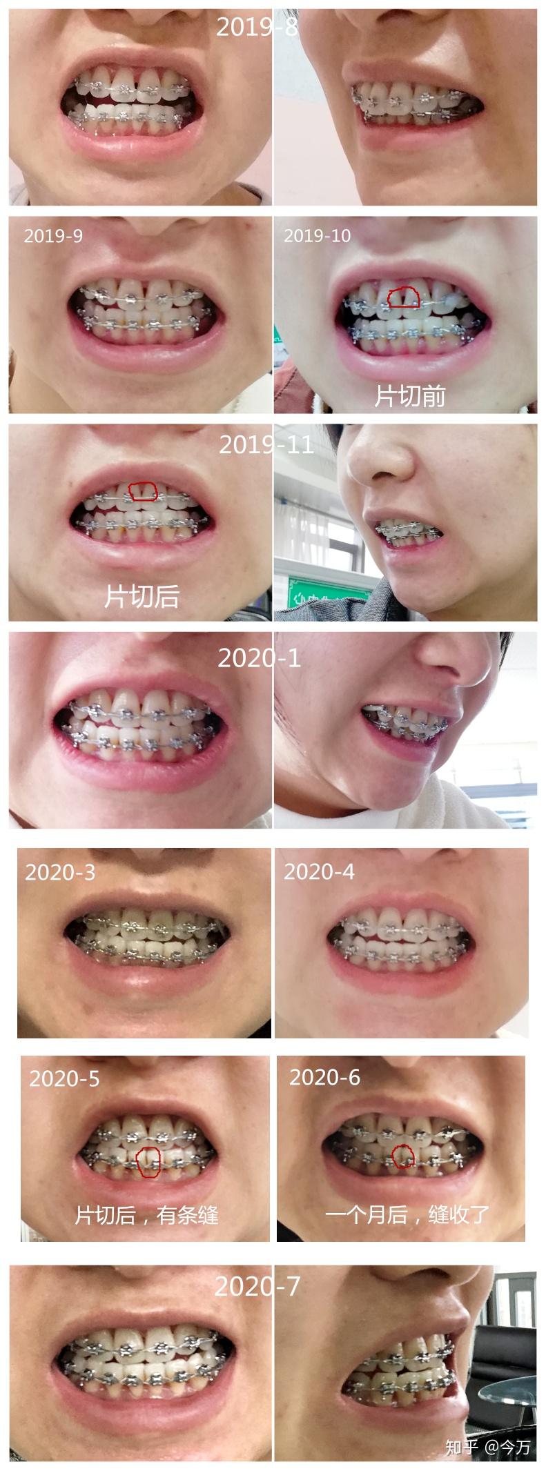 Kaiyun：孕妇梦见刷牙是什么意思