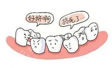 Kaiyun：牙齿矫正的最佳年龄是多少
