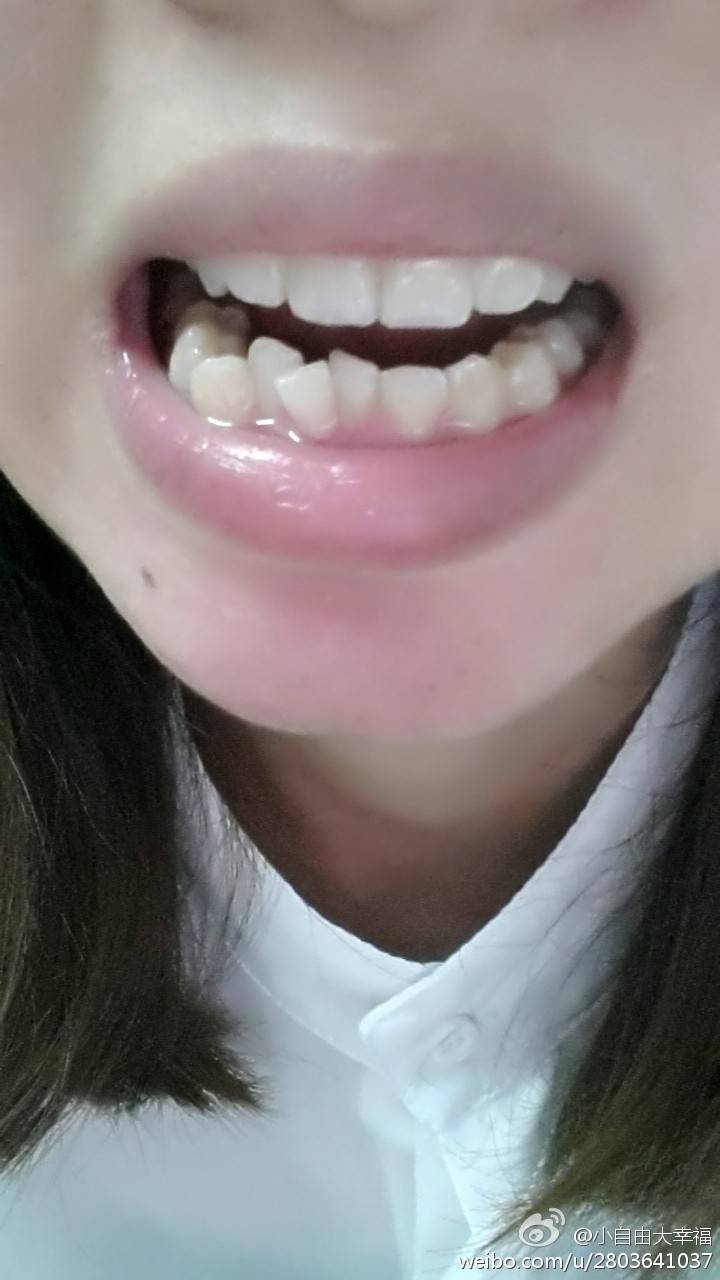 种牙价格能否迎来“退烧”时刻？