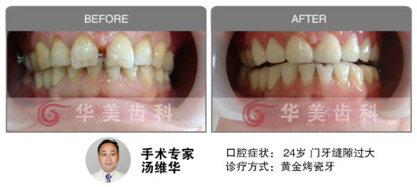 宁医大总院口腔医院正畸科夜间门诊正式开诊