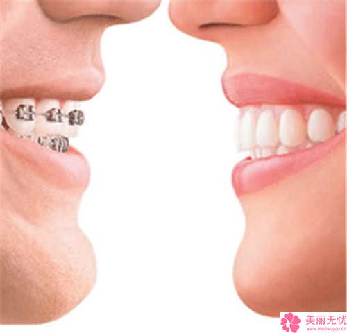 专家称辉瑞新冠疫苗有后遗症 引发多种长期症状