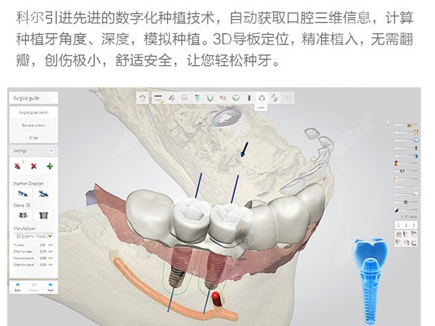 从中国数字化口腔设计大赛看口腔未来