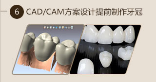 数字化种植技术助力口腔健康患者重拾自信笑容