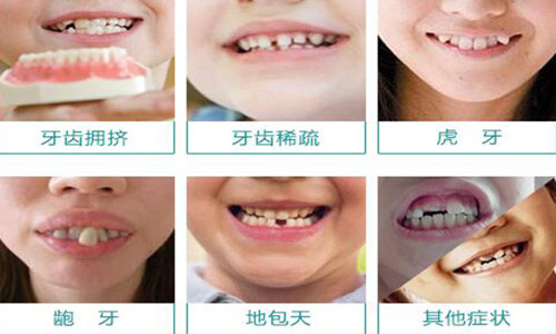 济南治疗慢性牙周炎医院哪家好