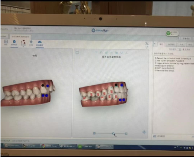 数智口腔 创赢未来 专家看好日照在口腔医疗创新与数字化应用的前景