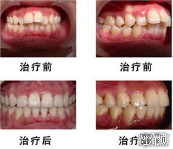 养娃如同“碎钞机”？揭秘背后的甜蜜负担！