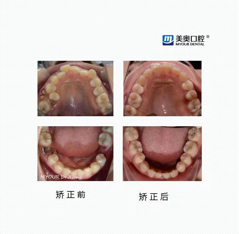 83岁高明丧子后首露面满头白发神情黯然儿媳发文令人泪目