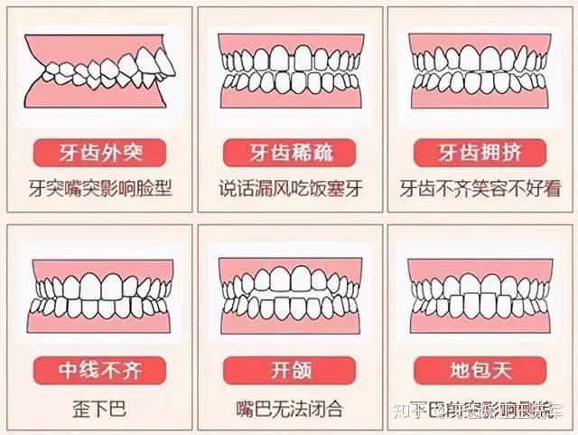 从海狸家口腔经营无证牙套看中国医疗到底怎么了？