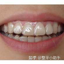 清明节这几天晚上最好不要出门