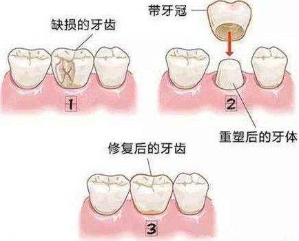 Deepseek分析：属猪的人最佳婚配此生富贵子孙满堂