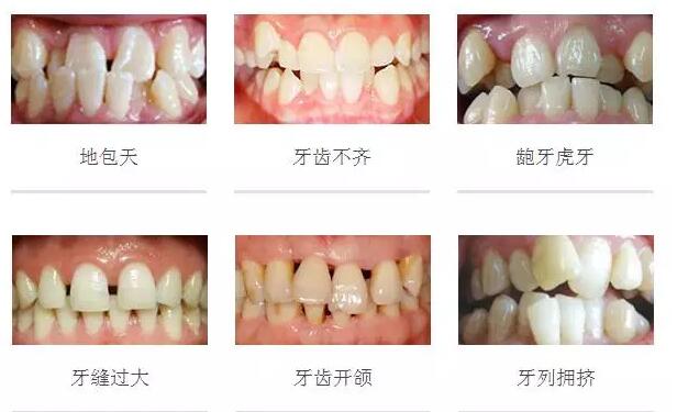 无损安装方案奥迪S1KT绞牙避震解决硬减震问题