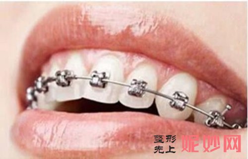 种植牙技术的新方向