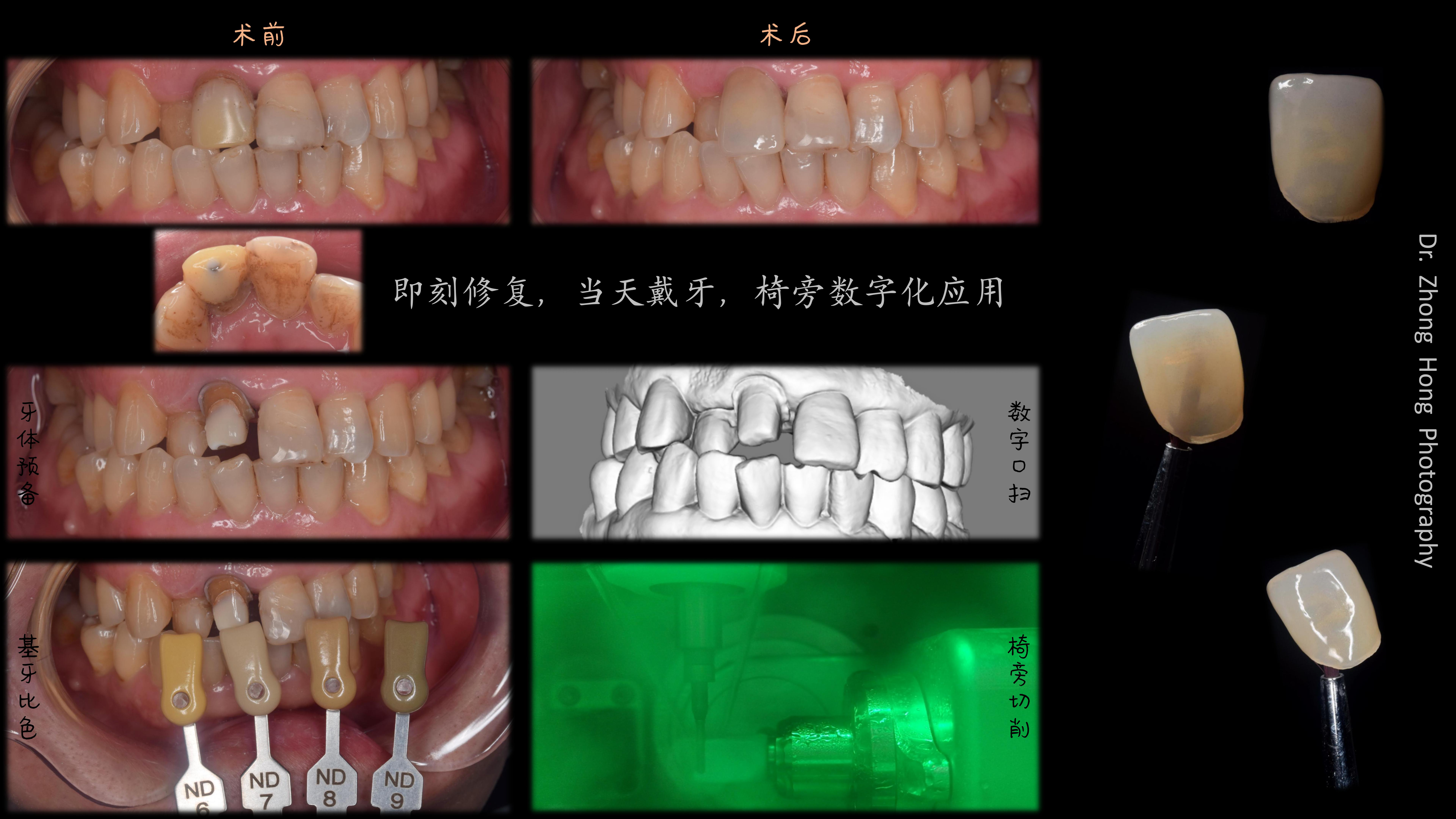 AI赋能基层医疗：仁怀首个乡镇卫生院引入DeepSeek 开启智慧医疗新篇章